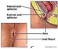 柴胡舒肝丸治疗肛门坠胀吗,柴胡疏肝散治便秘肛门下坠