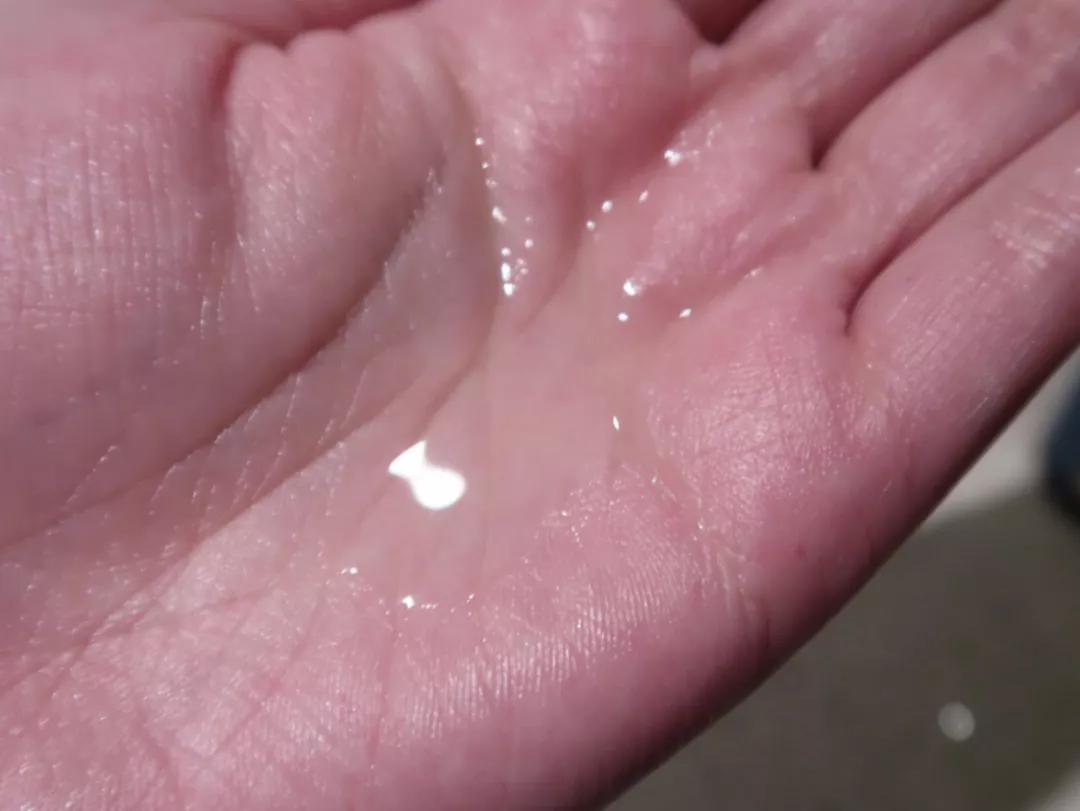 刷酸真的烂脸吗,刷酸烂脸后还继续刷吗