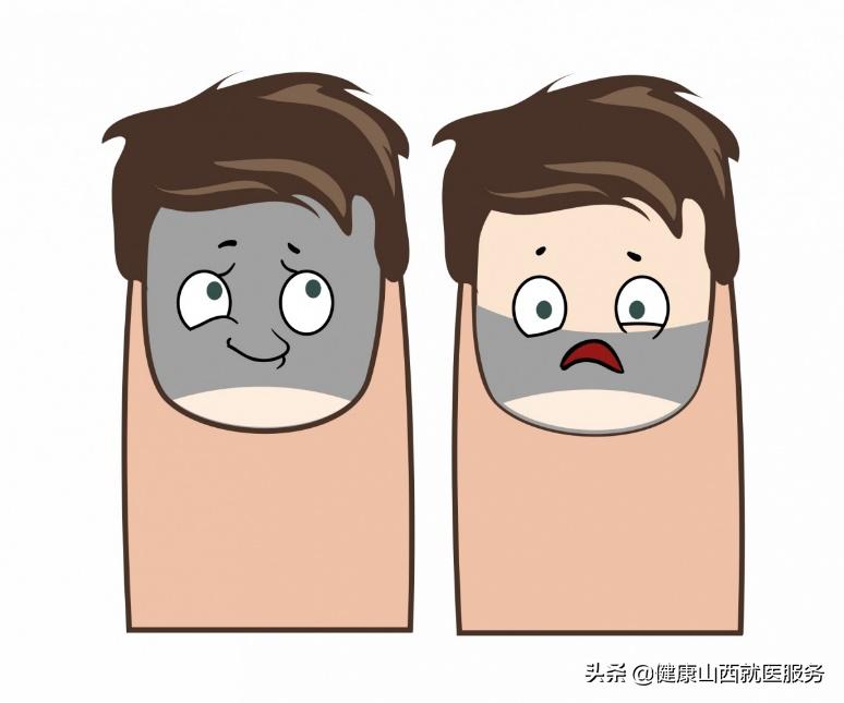 得了灰指甲怎么办能治好吗,得了灰指甲怎么办才能治好