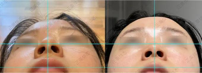 拯救颧骨高的教程,拯救脸大女生