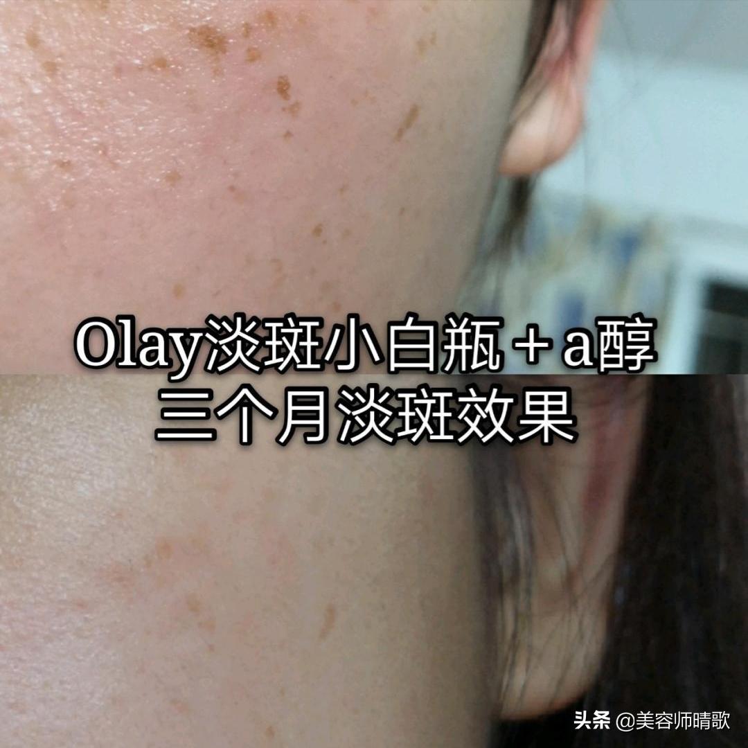 谷雨美白精华能变白吗,什么加美白精华可以变白