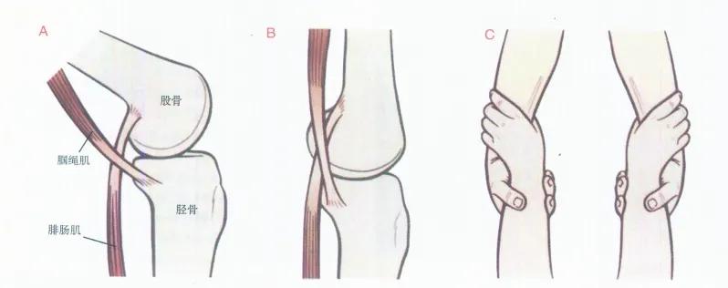 全身关节都有毛病怎么治,膝关节为什么会发炎
