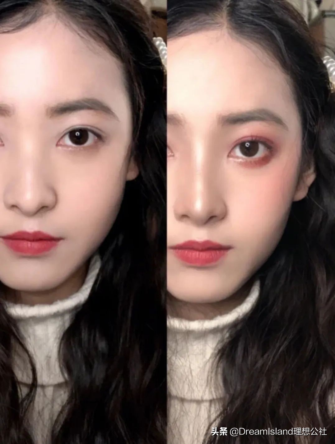 玻尿酸高光排名,打玻尿酸高光推荐