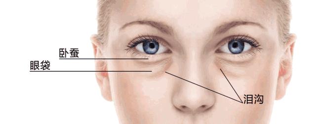 皮肤松弛引起的眼袋怎么祛除,祛除眼袋的小妙招红霉素软膏