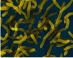 散装食品致病菌限量标准,食品微生物中的致病菌有哪些