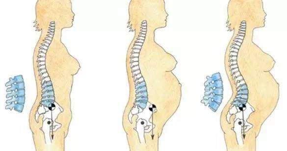 产后肚子膨隆,生完肚子会变小吗