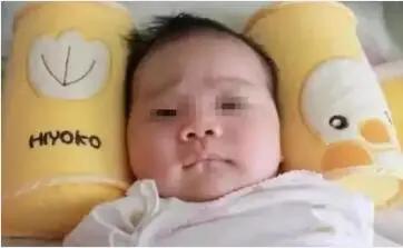 一岁宝宝睡偏头戴婴儿矫正头盔,七个月宝宝戴头盔多久能纠正头型