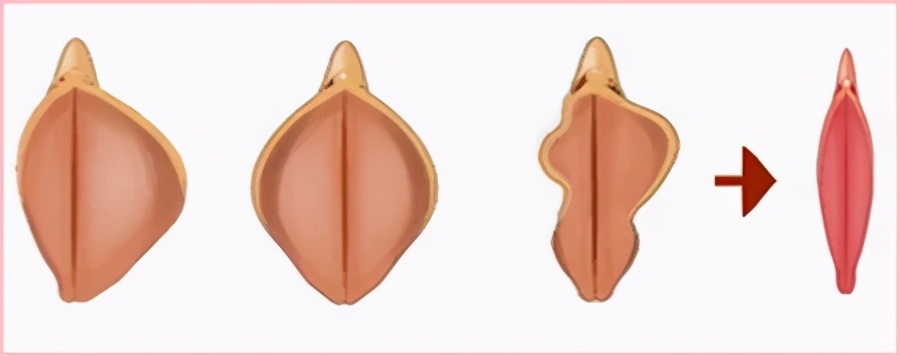 什么情况不可以做私密整形,哪个年龄段适合做私密整形