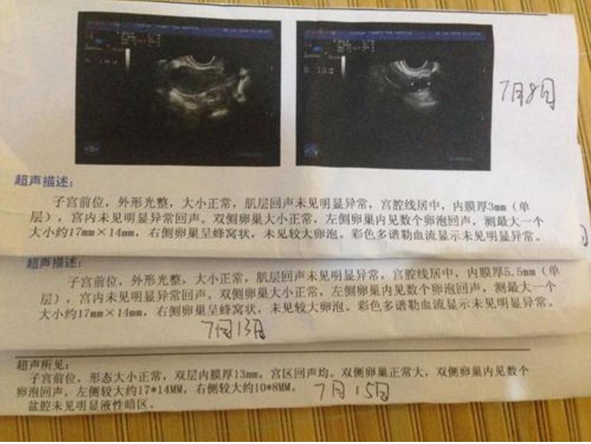 打胎隐瞒流产史有影响吗,孕检隐瞒一次人流史会怎样