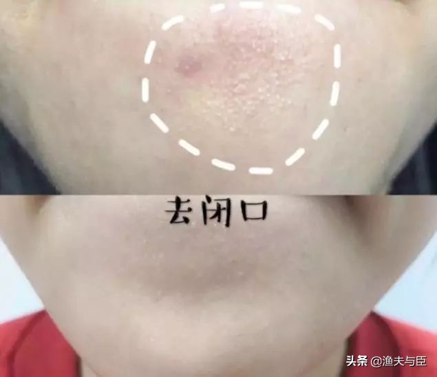 小苏打去黄牙小妙方,小苏打可以美白护肤吗