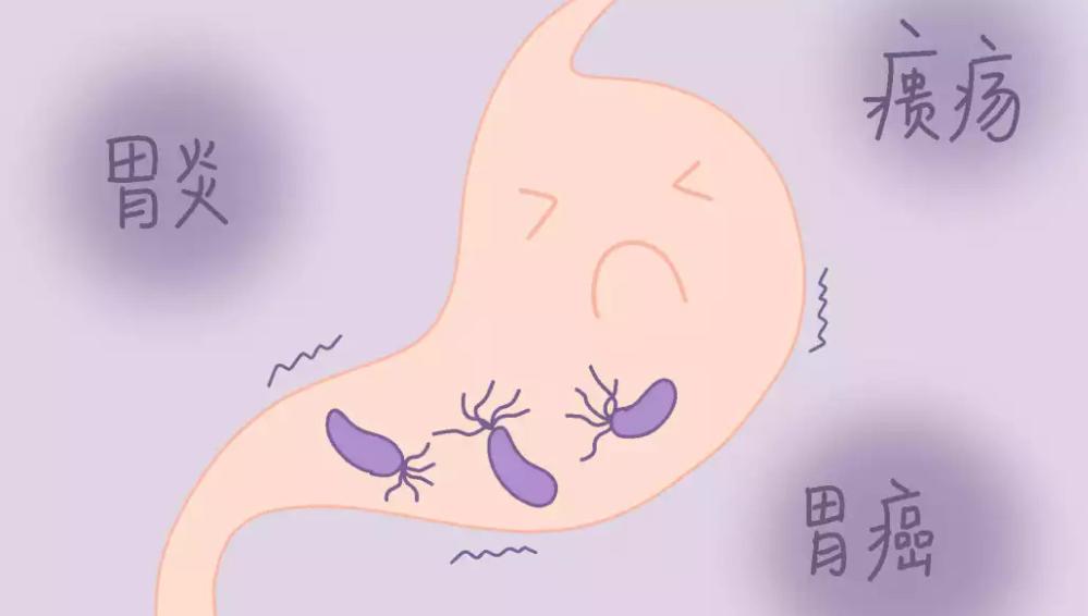可以通过服用益生菌来对抗幽门螺杆菌？医生为你理清真相