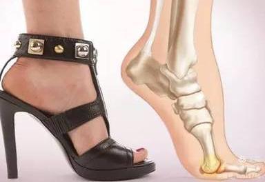 太原中心医院汾东院区骨科,太原汾东中心医院骨科拇外翻大夫