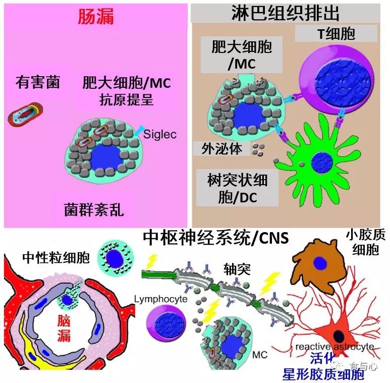 肠漏症的三大指标,肠漏症和脑漏症