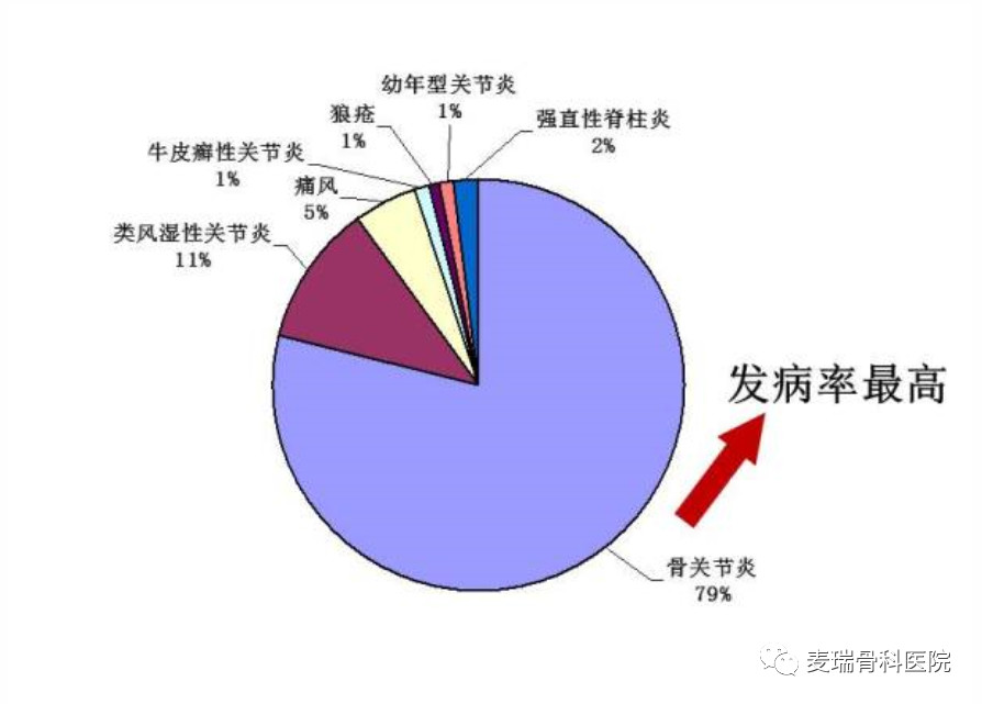 关节肌肉肿胀僵硬疼痛吃什么药,关节疼痛压痛僵硬关节肿胀