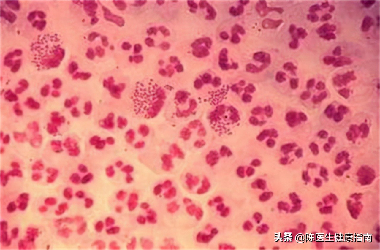 阿莫西林消炎药属于抗生素不,阿莫西林并非万能药