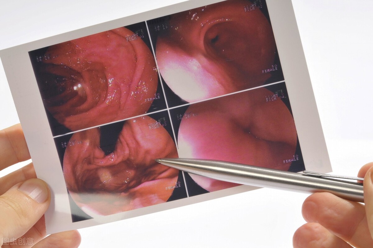 胃镜检查前，这些事一定要知道