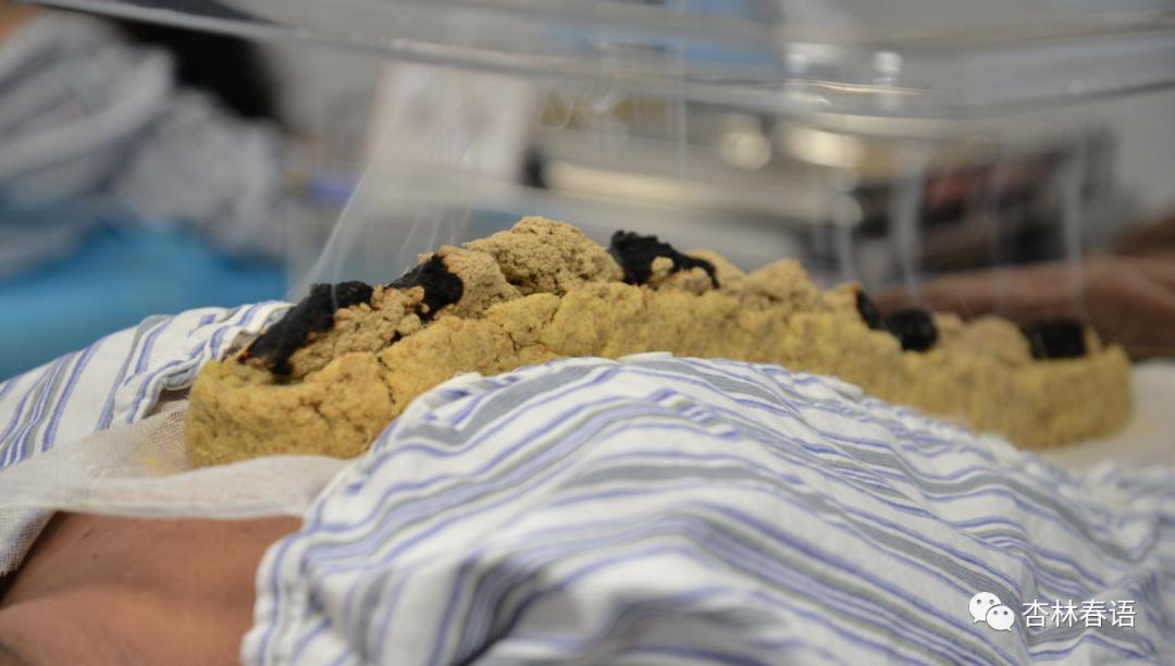 小诊室大优势石家庄市中医院中医护理门诊正式开诊啦