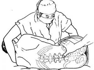 腰椎间盘突出我们应该怎么更好的治疗