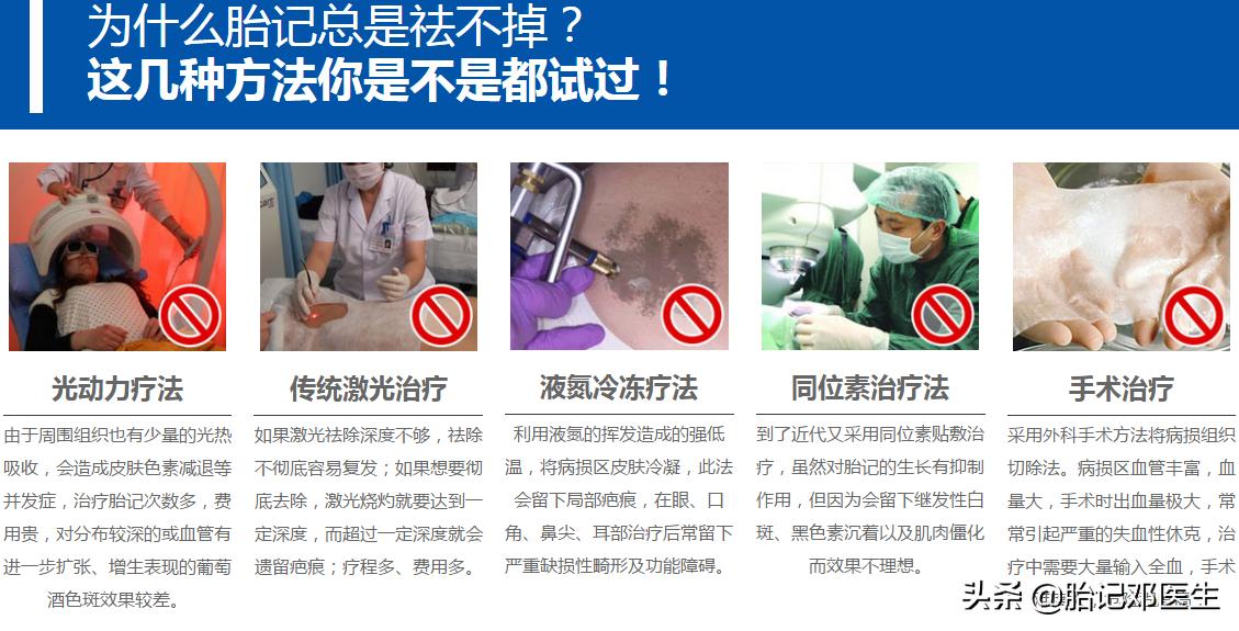 诊治鲜红斑痣过程中需要注意哪些东西