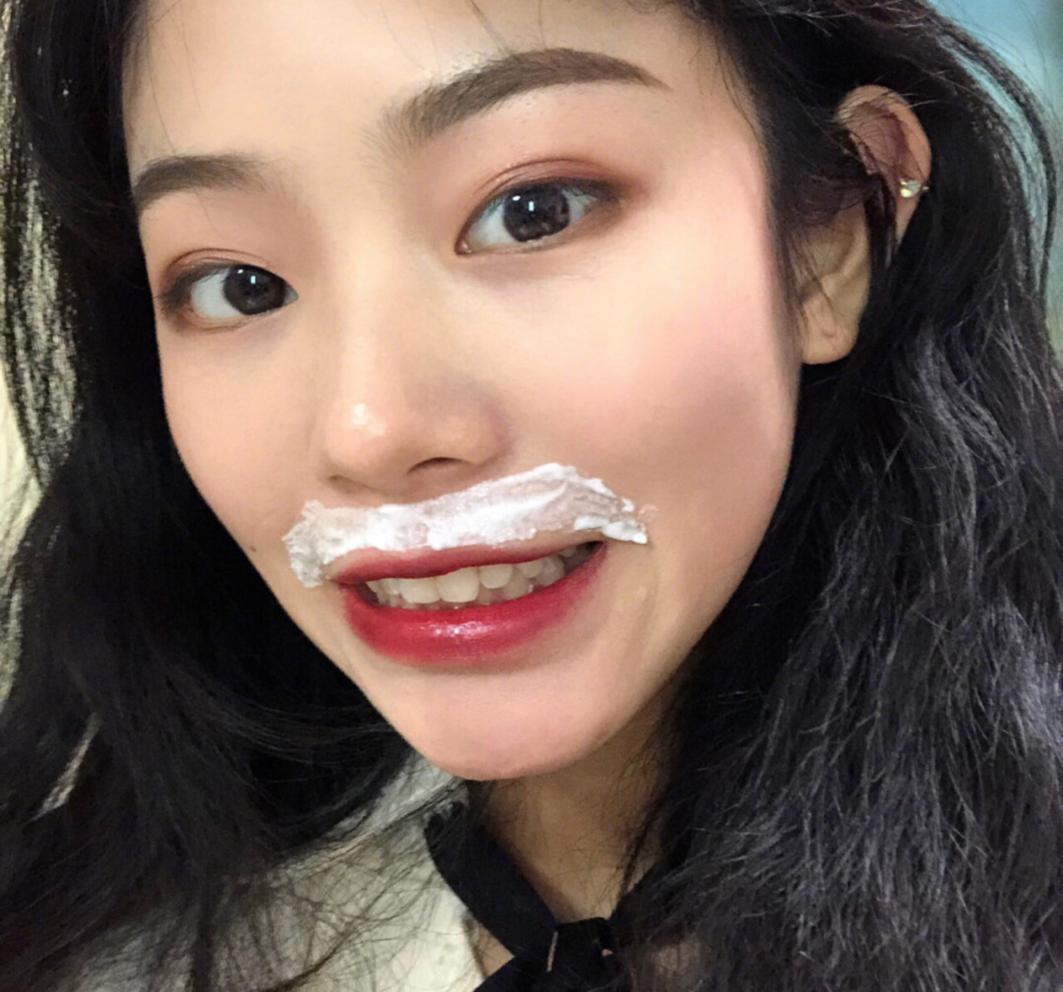 如何去除唇周小胡子,小胡子唇周黑怎么去除