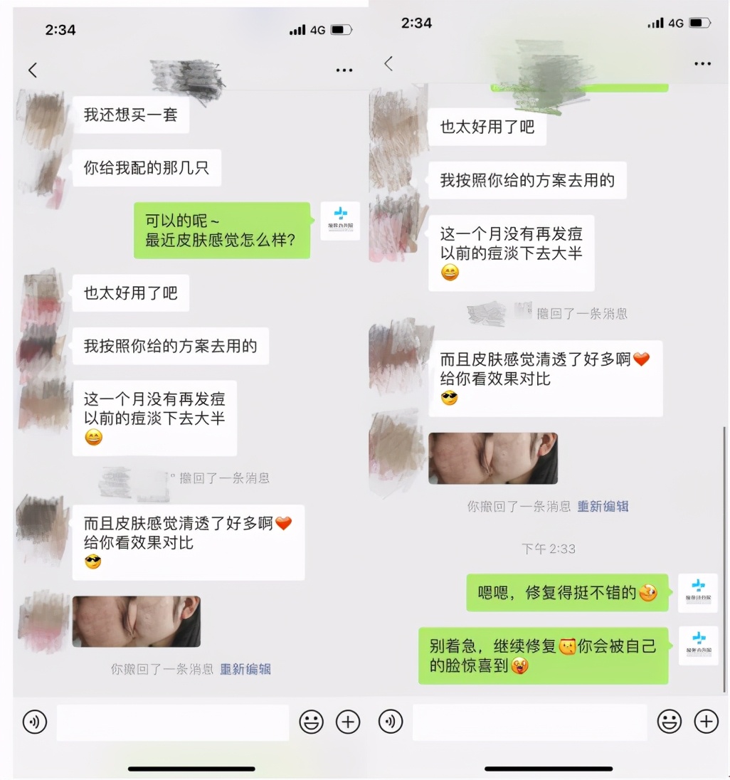使劲怼用产品，为啥痘总不能断？DermaSign
