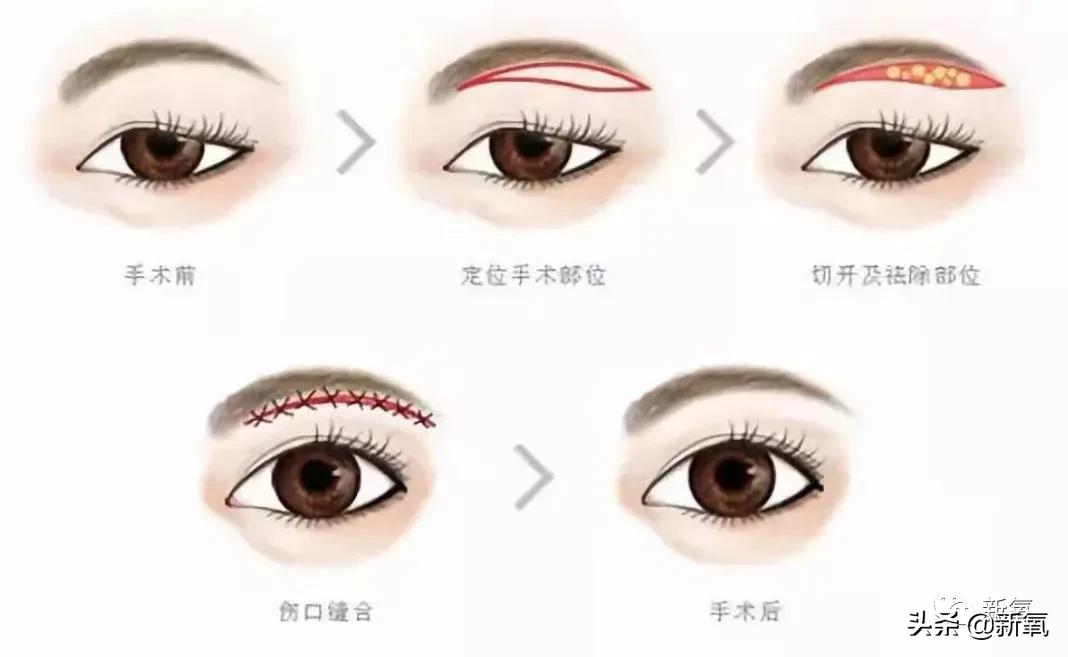 从万人嘲到万人捧,从万人嘲到万人迷