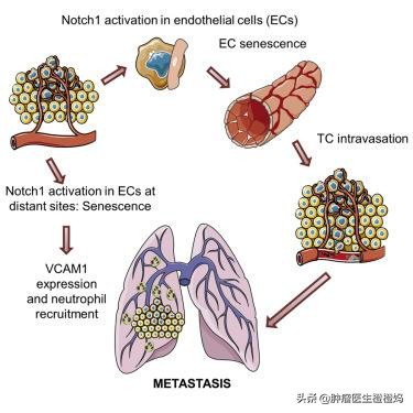 鼻咽癌转移了怎么办?医生告诫定期复查很重要,4种治疗要知道