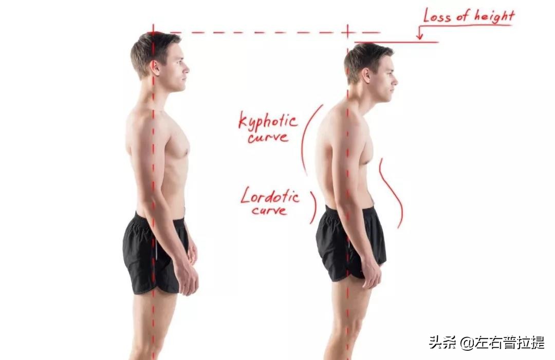 泰勒探颈毁气质？杨幂驼背变猥琐？教你1招轻松变美