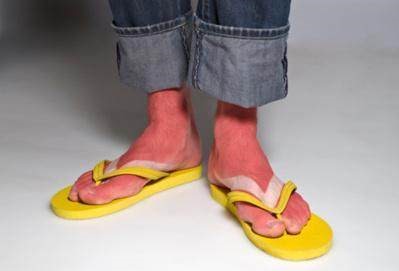 穿人字拖会影响腿型吗,穿人字拖对脚有伤害吗