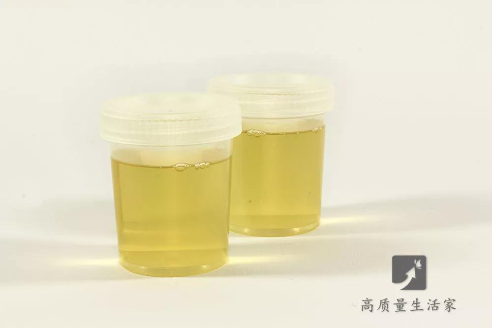 一喝水就尿多和喝水没尿哪个好,喝点水就尿多是肾虚吗