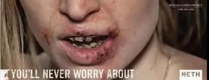 我的笑容就像一个空洞！”22岁女子吸毒6年，瘦到脸凹牙拔光…