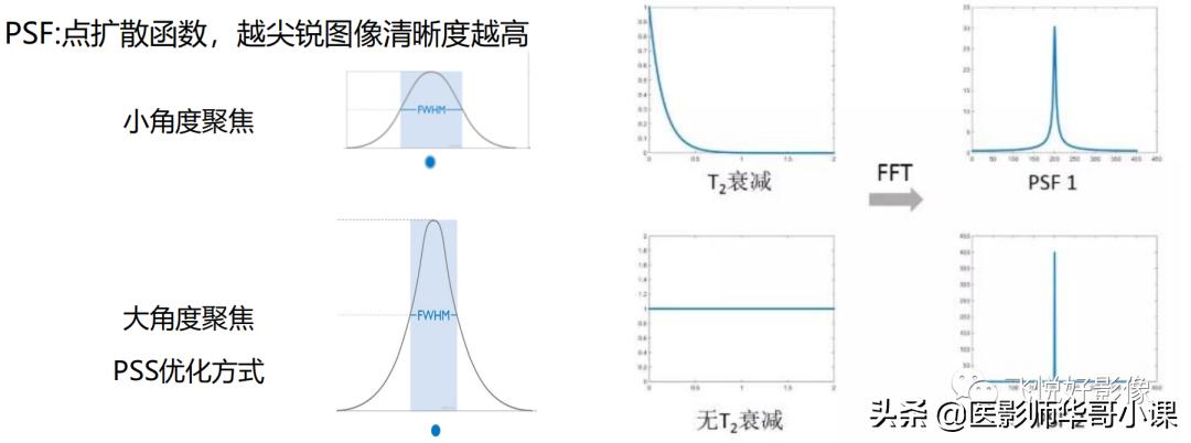 飞利浦磁共振波谱扫描方案,飞利浦1.5t磁共振mri操作使用手册