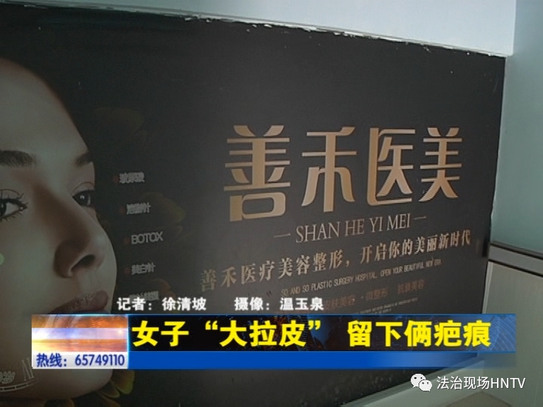 濂冲瓙鎷夌毊鎵嬫湳鍚庣暀澶氭潯浼ょ棔,娌冲崡閮戝窞濂冲瓙鎷夌毊鎵嬫湳