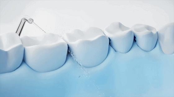 小米洗牙器四种模式,小米洗牙器9.9