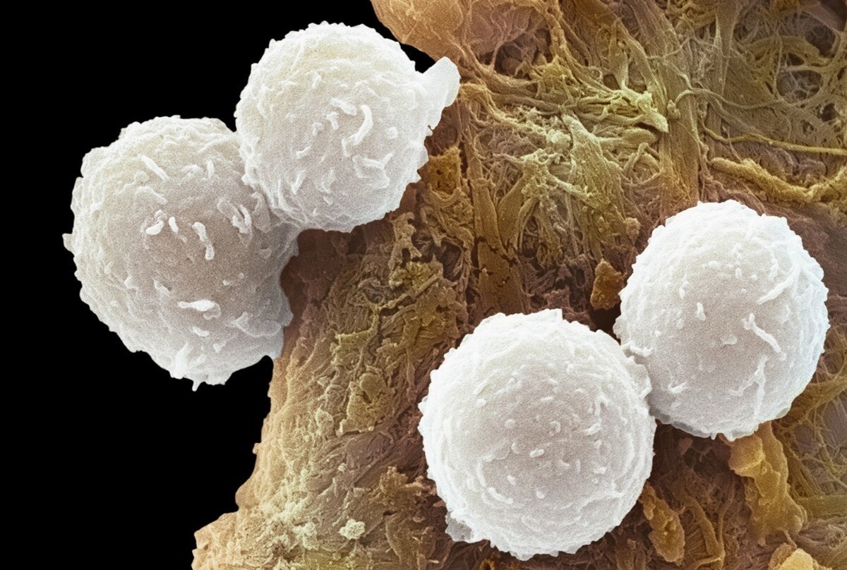 感冒发烧时为什么不能喝水,感冒发烧为什么不给打针