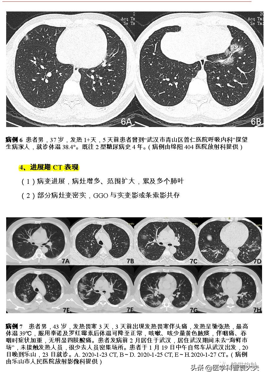 最新新型冠状病毒肺炎的指南,最新新型冠状病毒肺炎防控指南