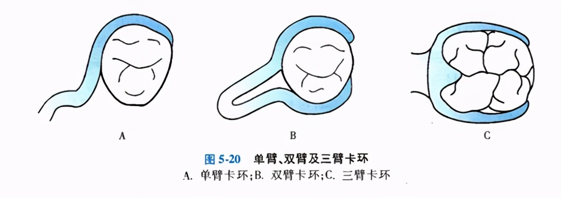 牙列缺损的可摘局部义齿修复题库,牙科美学修复精讲