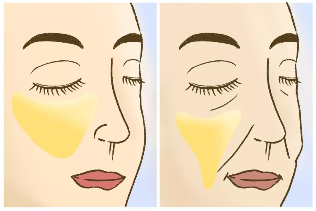 最有效的法令纹贴,如果你有眼袋法令纹