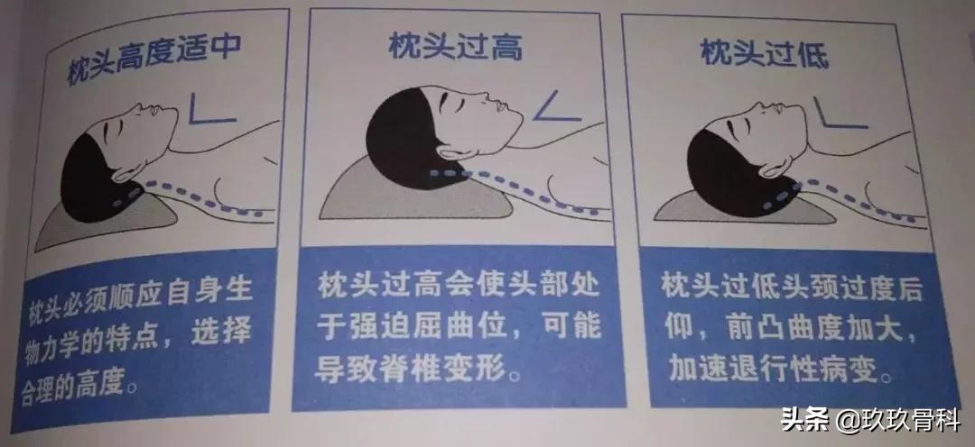 颈椎治疗法——麦肯基疗法