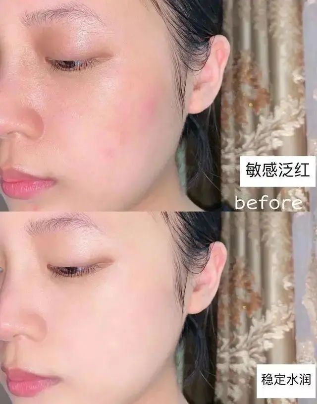 睡前坚持皮肤变好,睡前两个动作皮肤变好