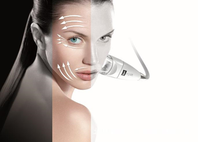 告别黑眼圈改善眼袋鱼尾纹,轻松告别鱼尾纹