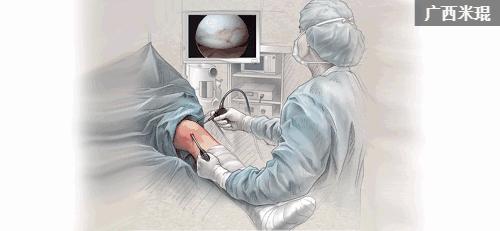 骨科大夫米琨为您详解:关节痛了怎么办?