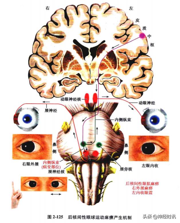 脑干解剖,脑干神经解剖