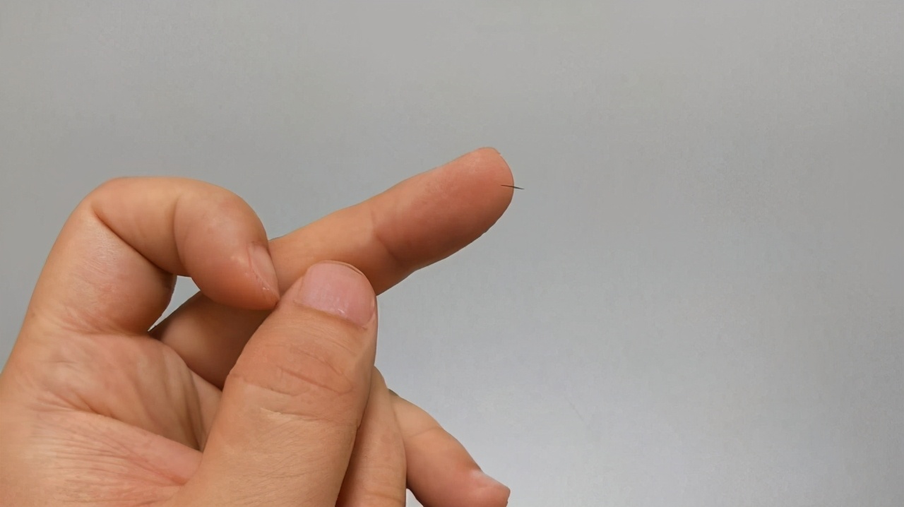 手指里扎了小刺看不见怎么弄出来,手指进了一根小刺拔出来后鼓起来