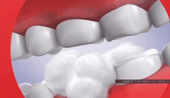 简单三招告别口臭尴尬,口臭的小妙招一招搞定