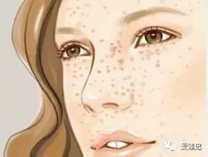 用祛斑霜为啥斑还越来越多,不要浪费护肤品