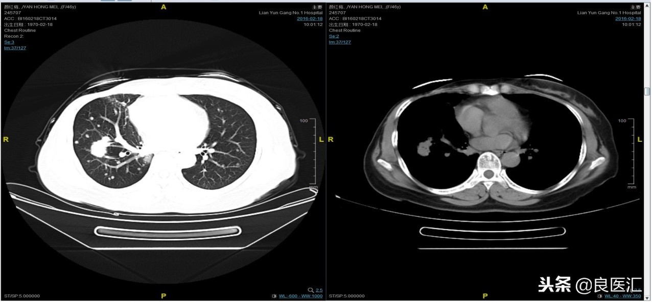 美图秀秀成功案例,美图秀秀实战案例