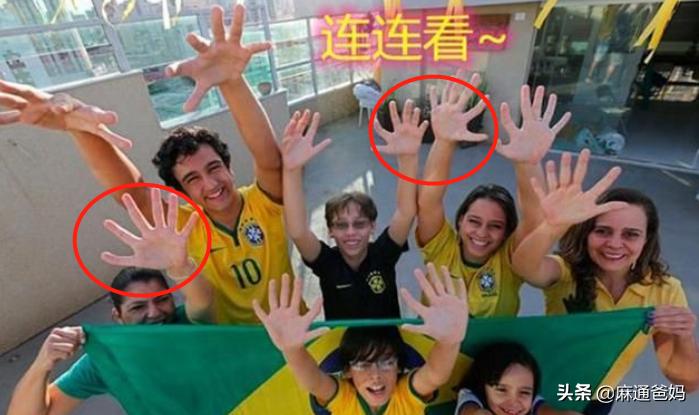 六个手指孩子,六指家族是真的吗