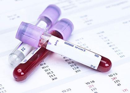 女生做全面检查要做什么项目,女生个人体检都检哪几项最好