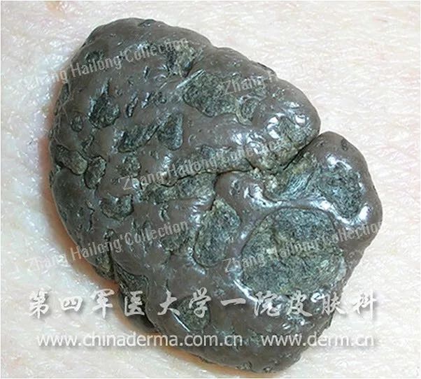 Ohno！老妈脸上出现了老年斑...